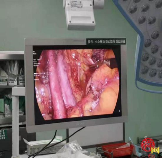 微创技术再上新台阶 济南市四院成功完成两例腹腔镜下子宫内膜癌分期手术